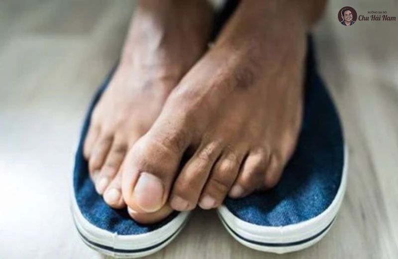 Giữ chân sạch – bí quyết ngăn mùi giày từ gốc.